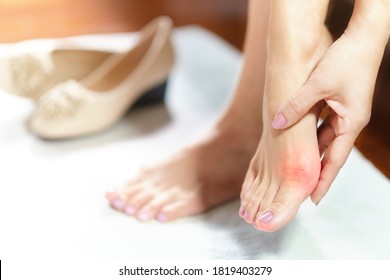 Woman feet problem. Closeup, Beautiful working woman's hand massaging her bunion toes in bare feet to relieve pain due to wearing pointy and narrow shoes. Medical condition - bunions (Hallux valgus).