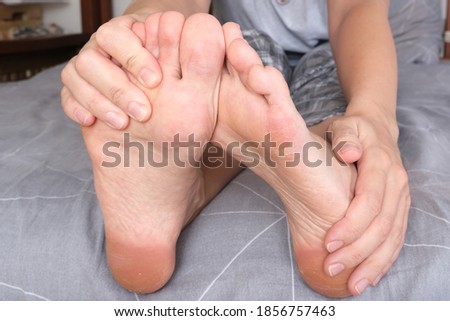Woman female holding her barefeet with dry skin and callous close up.