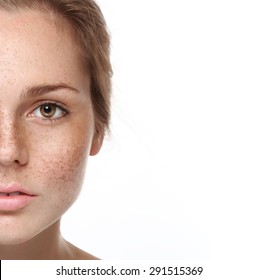 Woman Freckle Happy Young Beautiful Studio Portrait With Healthy Skin Half 