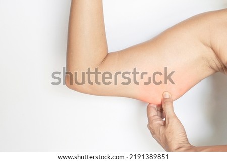 Woman gesture showing back muscles, under arms, with fat under the skin