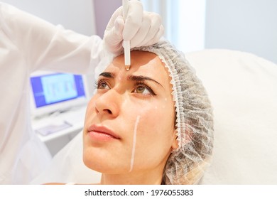 Woman Gets Forehead Wrinkle Marking For Wrinkle Reduction With Hyaluronic Acid