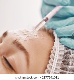 Woman Is Getting Filler Injection In Forehead. Anti-aging Treatment And Face Lift.  Injections Of Skin Rejuvenation.                       