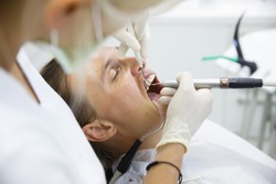 Woman Getting Her Gum Pocket Depth Measured With Periodontal Probe, Held By Dental Hygienist, Examining Progression Of Periodontal Disease. Dental Hygiene, Periodontal Disease, Prevention Concept. 