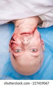 Woman Getting Into The Accident Having A Big Terrible Gash On Her Face Lying On The Operating Table. Top View