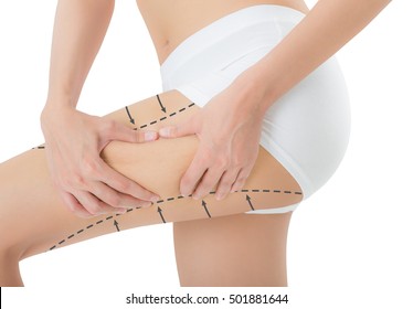 Woman Grabbing Skin On Her Thigh With The Drawing Black Arrows, Lose Weight And Liposuction Cellulite Removal Concept, Isolated On White Background.