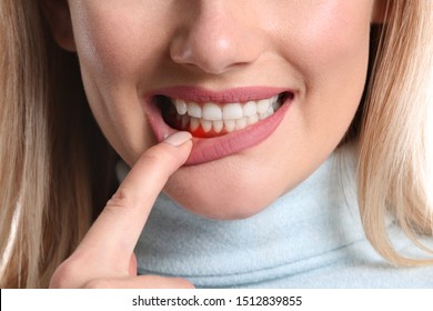 Woman with gum inflammation, closeup - Shutterstock ID 1512839855
