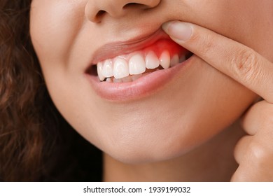 Woman with gum inflammation, closeup - Shutterstock ID 1939199032