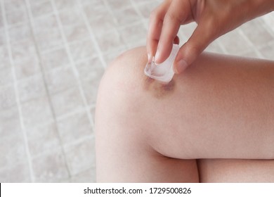 Woman Hand Hold Ice Cube  On Bruise On Her Leg Close Up Outdoor Natural Light