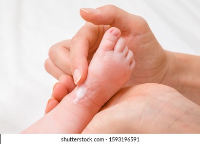Woman hand holding infant leg. Mother carefully applying medical ointment. Red dry skin allergy from milk formula or other food. Care about baby body. Closeup.