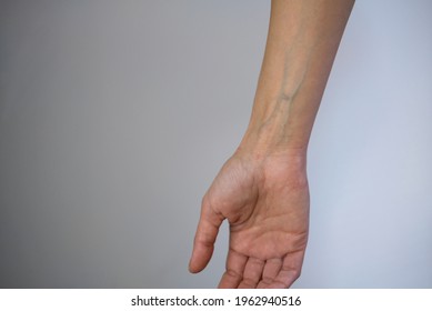 Hand Veins Images Stock Photos Vectors Shutterstock