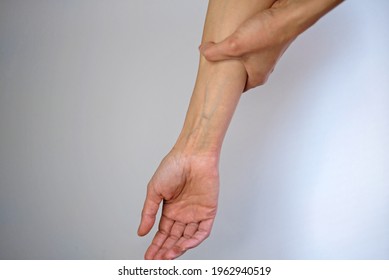 Woman Hand With Visible Veins Indicating Venous Disease, Hand Pain, Carpal Tunnel Syndrome, Vascular Disease, Forearm Pain, Wrist Problems. Photo With White Background.