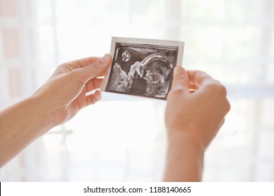 Woman Hands Holding 3D Image Scan Of Unborn Baby, Home Window Interior. Female Future Mother Looking At Ultrasound Photograph. Medical Health Check, Pregnancy Care Healthcare. Lifestyle.