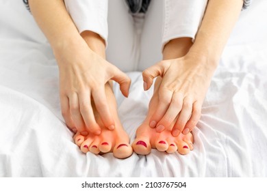 Woman Hands Scratch Her Legs Sitting On White Bed At Home. Itchy Skin, Redness, Fungus, Redness, Bacterial Infection, Allergic Reaction, Eczema, Dermatitis Of The Foot. Health And Skincare Concept.