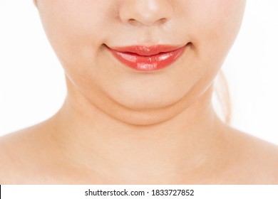 A woman has a lot of fat on her chin.