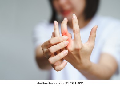 Woman has finger joint pain due to rheumatoid arthritis. Health care concept. - Shutterstock ID 2170615921