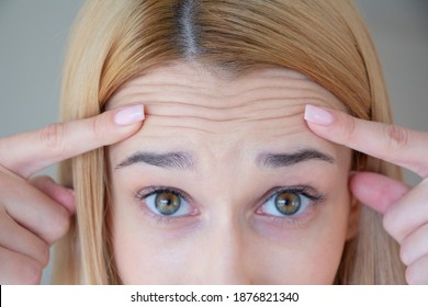 A woman has many facial wrinkles on her forehead.