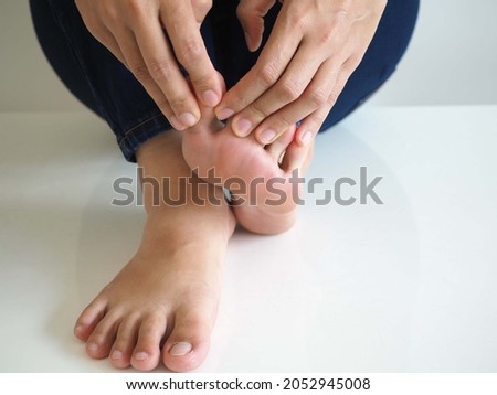 Woman has painful and inflamed gout on foot. closeup photo, blurred.