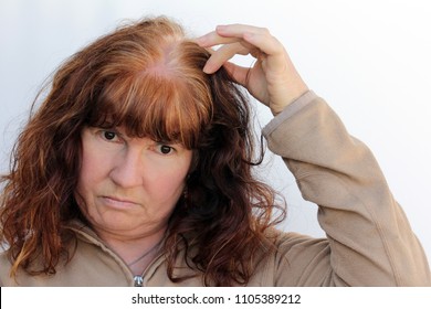 Imagenes Fotos De Stock Y Vectores Sobre Hormonal Hair Loss