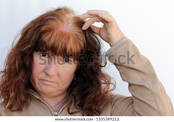 Woman Has Problems Hair Loss Sensitive Stock Photo Edit Now