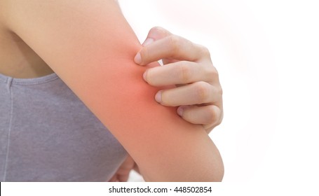 Woman Has Skin Rash Itch On Arm And Scratch Itching By Hand 