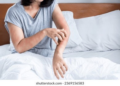 woman have problem with dust mites allergy bedding hand scratching her itchy and rash skin  - Shutterstock ID 2369156583