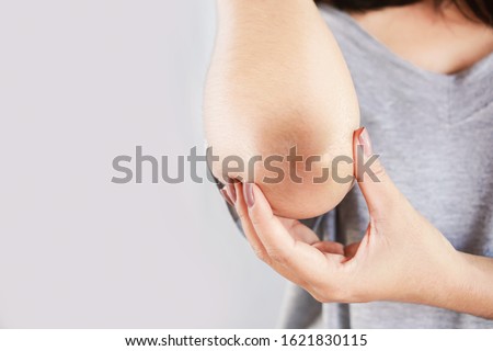 woman having problem with dry,damage and dark skin on elbow closeup 