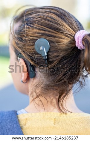 Woman head with cochleral implant hearing aid
