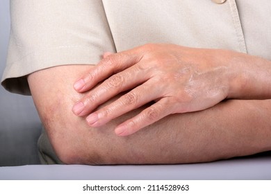 Woman Hiding Face, Posing With Crossed Arms. Human Expression.hands Crossed Over Body In Defensive Pose.