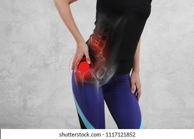Frauen mit Hüftgelenk-Schmerzen. Sportverletzung