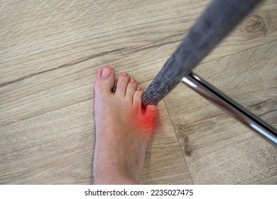 Woman hit chair with the little toe. Incident at home. Red spot showing injury of foot little finger - Shutterstock ID 2235027475