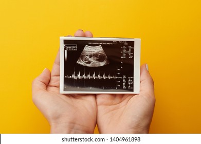 Mujer con foto de ultrasonido creciendo durante el embarazo