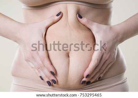 Woman holding fold of skin, cellulite on female body, beige background, studio shot