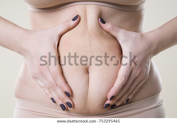 Woman holding fold of skin, cellulite on\
female body, beige background, studio\
shot