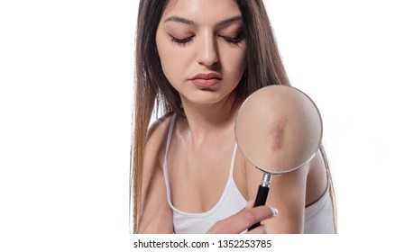 woman holding magnifying glass and showing surgery scar. Scars removal concept, close up, selective focus