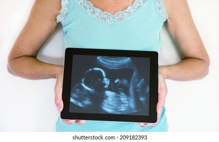 Woman Holding Tablet With 3d Ultrasound Scan.