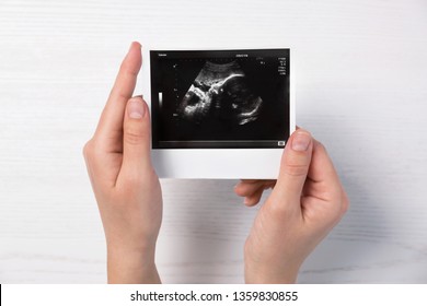 Woman Holding Ultrasound Photo Of Baby Over Table, Top View