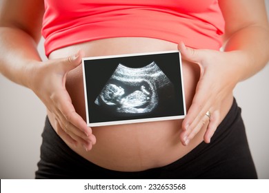 Woman Holding An Ultrasound Scan Of Her Unborn Baby