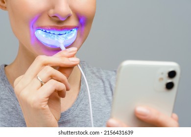 A Woman Holds In His Hand An Ultraviolet Lamp For Home Teeth Whitening. A Snow-white Smile After Bleaching.