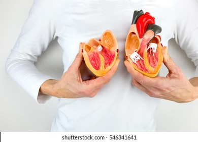 Woman holds open model heart at white body
