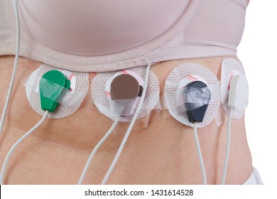 Woman Holter Monitor Device Daily Monitoring Stock Photo (Edit Now ...