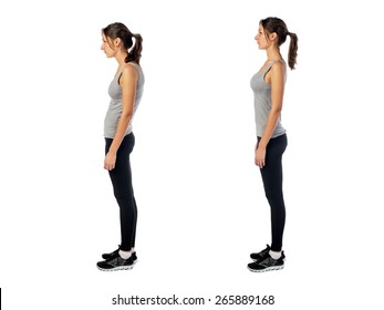 Woman with impaired posture position defect scoliosis and ideal bearing.