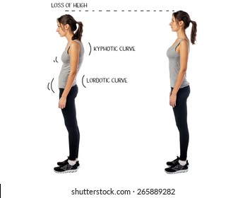 Woman with impaired posture position defect scoliosis and ideal bearing.