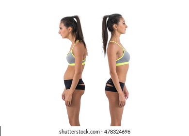 Woman with impaired posture position defect scoliosis and ideal bearing