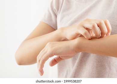 Woman Itchy Arm Due To Allergy To Skin Lotion.