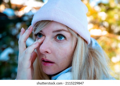 Woman Itchy Dry Eye Outdoors In Cold Day. Close Up Portrait Of European Woman Having Itching Eyes Health Problem. Sick Woman With Hat Outdoors In Winter Snow Touching Sensitive Blue Eye