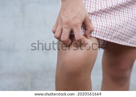 woman itchy skin on leg