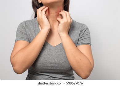 Woman Itchy Skin Scratching Her Neck