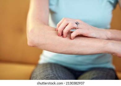 Woman With Itchy, Tingling Arms Scratching Skin.