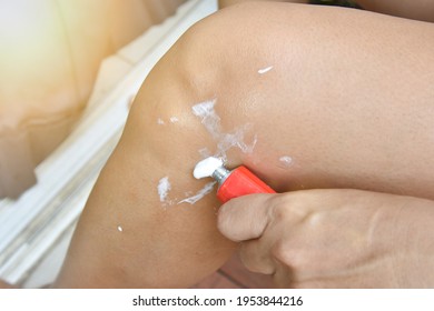 Woman Leg Apply The Balm On Injury Knee, Pain From Sport Woman Use A Cream To Relief Painful