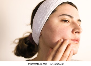 Woman Looking At Her Face. A Person With Sensitive Skin And Rosacea.